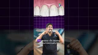 உங்கள் ரீடெய்னர் உடைகிறதா? - How to remove your retainers | Dr.karthikeyan | Denta Kings
