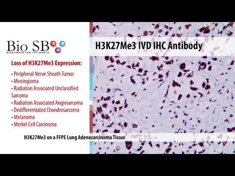 Bio SB - 2022 New H3K27Me3 Antibody for IHC