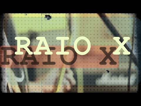 RAIO X - Projeto Trator