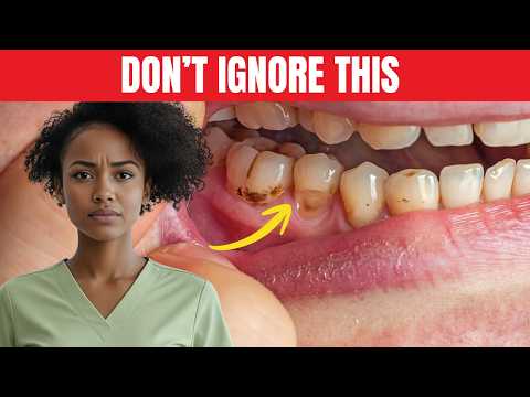 Teeth Breaking Under Pressure? Stop Ignoring the Signs