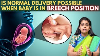 What Happens If The Baby Is In Breech Position - சுகப்பிரசவம் சாத்தியமா | Dr Deepthi Jammi