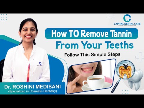 How To Remove Tannin From Your Teeth's || Dr. Roshini Medisani || Capital Dental Care