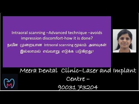 நவீன முறை INTRAORAL SCANNING மூலம் பற்களின் அளவு  எவ்வாறு எந்த சிரமும் இல்லாமல் எடுக்க படுகிறது??