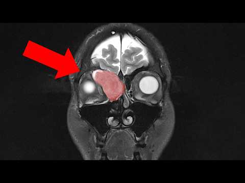 Only a few doctors know exactly what this is... for now