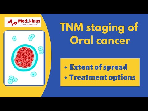TNM staging of oral cancer l Oral surgery l Mediklaas