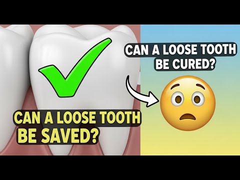 ✅ Can a loose tooth be saved? / Can a loose tooth be cured? 👈😳