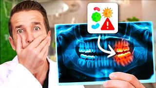 Toothache? Do this BEFORE Seeing the Dentist!