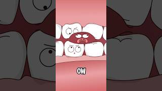 The Truth Behind Your Frequent Ulcers #shorts #animation #webtoon