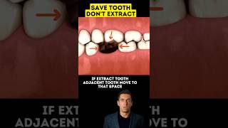 Don't Extract Tooth🦷 Save Tooth😬😬 #youtubeshorts #shorts #dentist #tooth