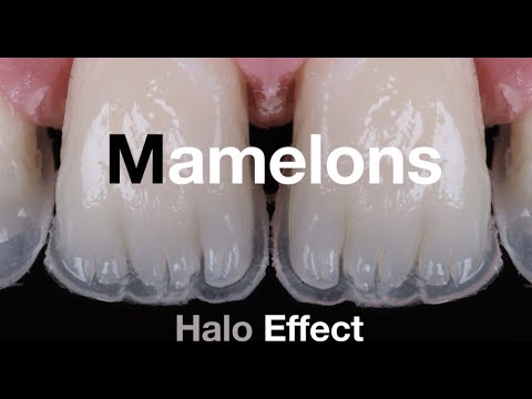 Tips series 2 : How to make dentin layering and shaping mamelons ?