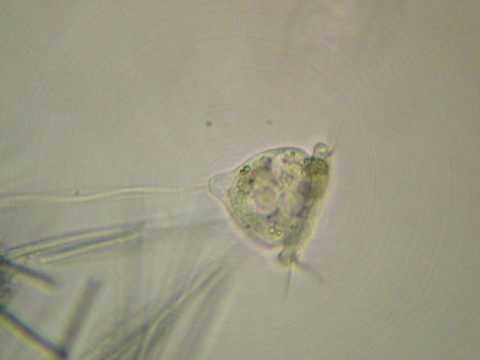 Vorticella