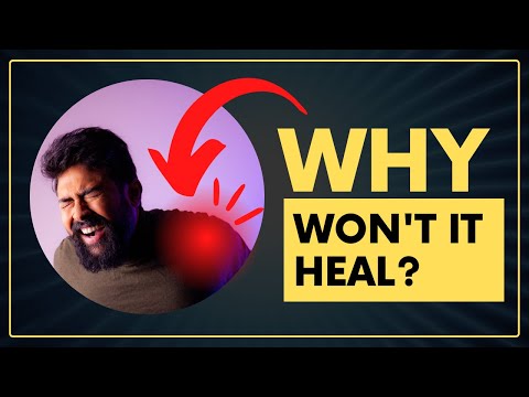 How Serious Is My Shoulder Injury? Why Isn’t My Shoulder Pain Going Away?