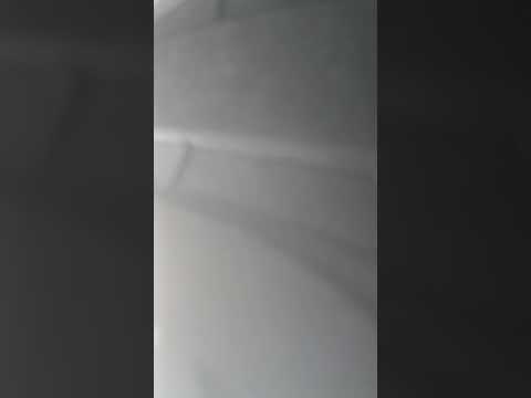 Audi S5 B8 4.2L v8 Stock Exhaust Sound 2/3 Muffler Delete 4k RPM Limiter