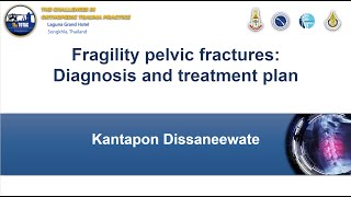 Fragility pelvic fractures: Diagnosis and treatment plan Dr.Kantapon Dissaneewate