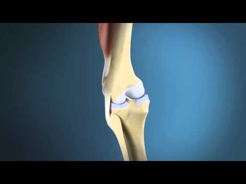 Die Anatomie des Knies / Anatomie Knie