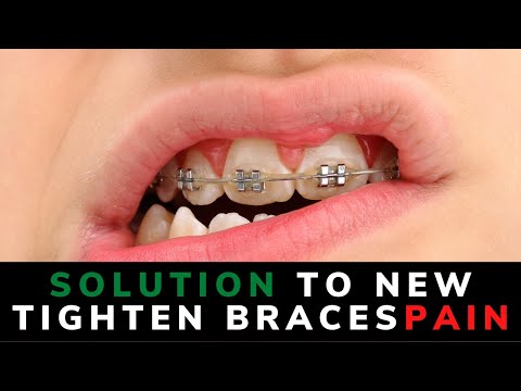 how to get rid of braces pain||new braces pain||tighten braces pain