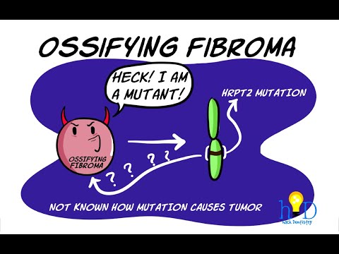 Cemento-ossifying fibroma - Controversies, Clinical features, Radiology and  Histopathology