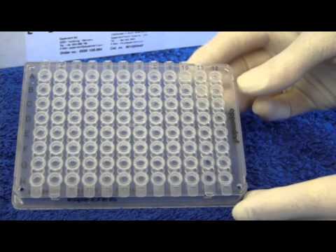 How to Pack DNA