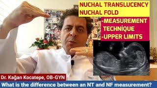 NT (nuchal translucency) and NF (nuchal fold) U/S measurements. The difference and upper limits.