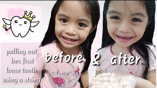 pulling her first baby tooth using string | not scary at all | first tooth fall out