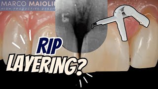Why Injection Moulding Composite is Superior to Layering - PDP228
