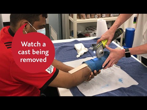 Watch a cast being removed