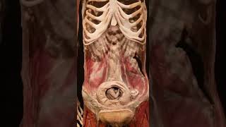 A Real Human Body With A Fetus In The Stomach - Bodies Exhibit Luxor Las Vegas