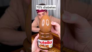 What is the best way to eat CHOCOLATE EGG? With more chocolate?😅❤️🍫| CHEFKOUDY