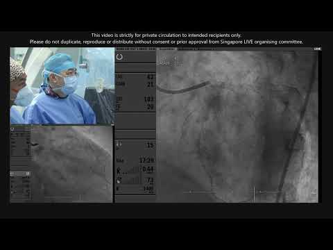 Left Main/ Multivessel Disease - SingLIVE 2023