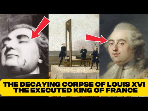 The Decaying Corpse Of Louis XVI - The Executed King Of France