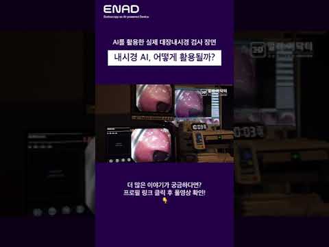 AI를 활용한 실제 대장내시경 검사 장면 │ 내시경 AI, 어떻게 활용될까?