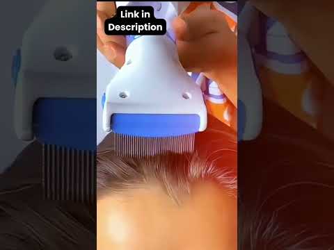 V-Lice Comb Machine: The Ultimate Solution for Lice Removal!