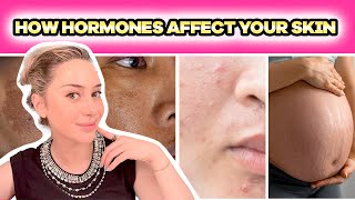 What No One Tells Your About Hormones & Your Skin: 20s, IVF, Pregnancy, Postpartum & Menopause