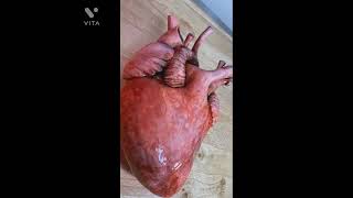 Actual Image Of Human Internal Organs| #shorts #neet #aiims