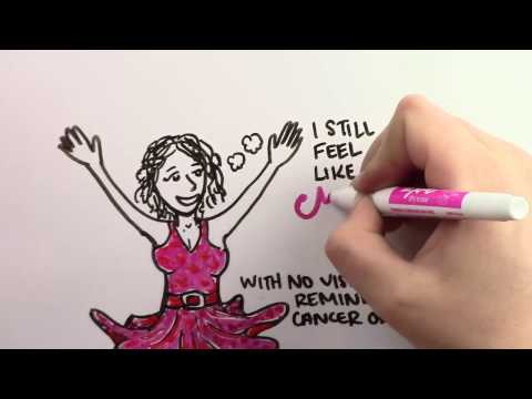 Hidden Scar Mastectomy