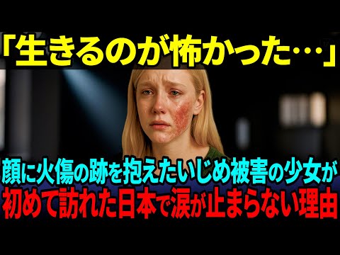 【海外の反応】「もう誰も信じられない…」顔に火傷を負ったアメリカの少女が“日本で涙を流した本当の理由”とは？