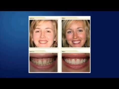 Boulder Cosmetic Dentist