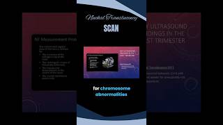 Perfect NT Scan Technique Explained Step-by-Step #ultrasound #sonography