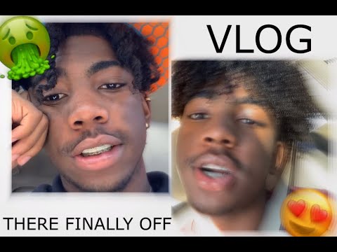 Vlogging Getting My Braces Off!!!!