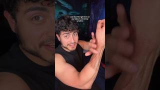 Arm Sensation after RFF Phalloplasty #ftm #transman #transmasc #shorts