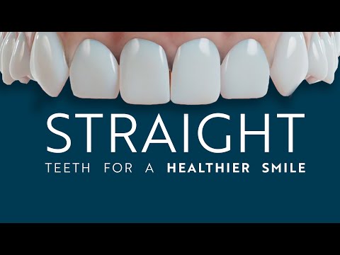 Straight Teeth for a Healthier Smile