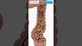 Digestive Animation of Multiple Cracked Masses Moving with Intestinal Peristalsis #guthealth #shorts