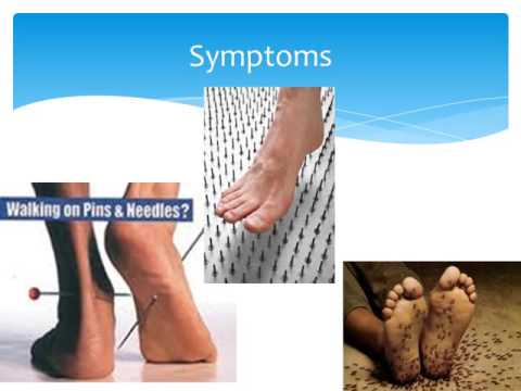 Best diabetic Foot doctor in Hyderabad 9246118509