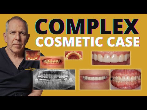 Anterior Tooth Wear Restoration with Bioclear, Implants & Dahl Techniques