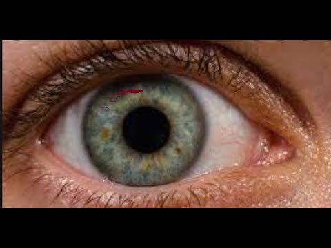 What is an eyes ? Structure of eyes. (Total technology)