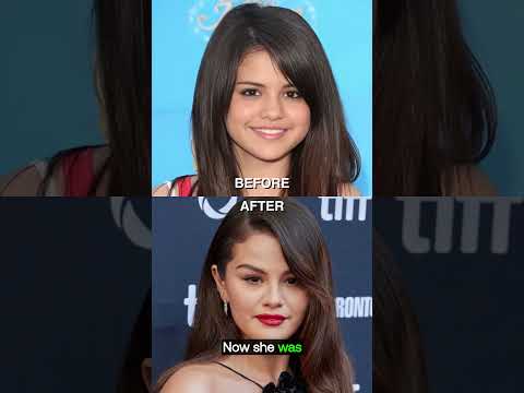 From Disney Star to Beauty Mogul: Selena Gomez's Glow-Up 🌟