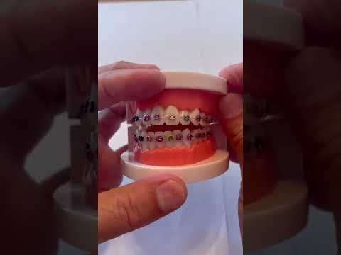 Ortho-buddy instructions #2