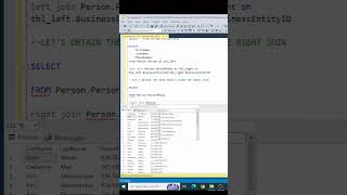 SQL Server - Beginner - Right Join  #sqlserver #sql #sqltips