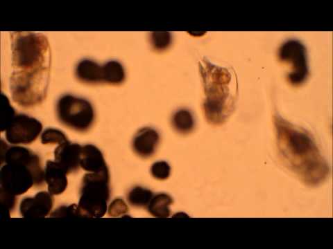 Rotifer Euchlanis sp - Zune720p_no_audio (repost)