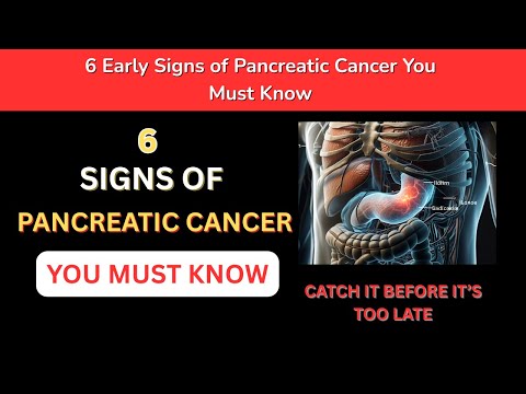 6 Early Signs of Pancreatic Cancer You Must Know – Catch It Before It’s Too Late